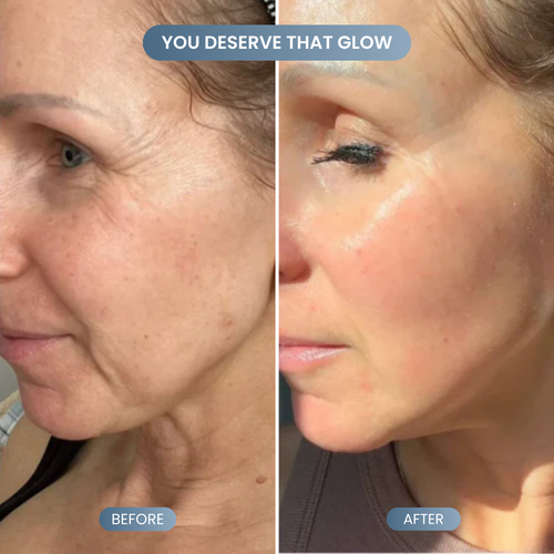 Silk Lifting Peptide Ampoule