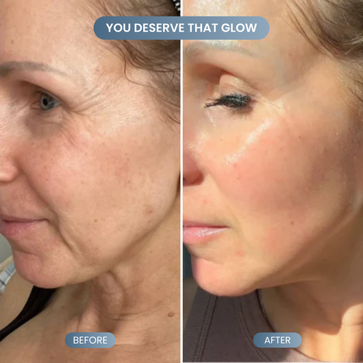 Silk Lifting Peptide Ampoule