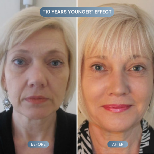 Silk Lifting Peptide Ampoule