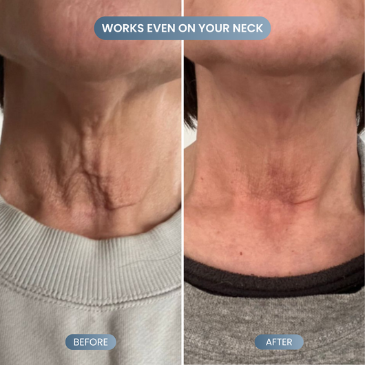 Silk Lifting Peptide Ampoule