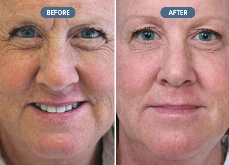 Get a Flawless Base in