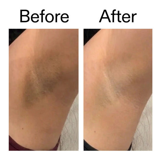 Smooth & Even Glycolic Body Stick