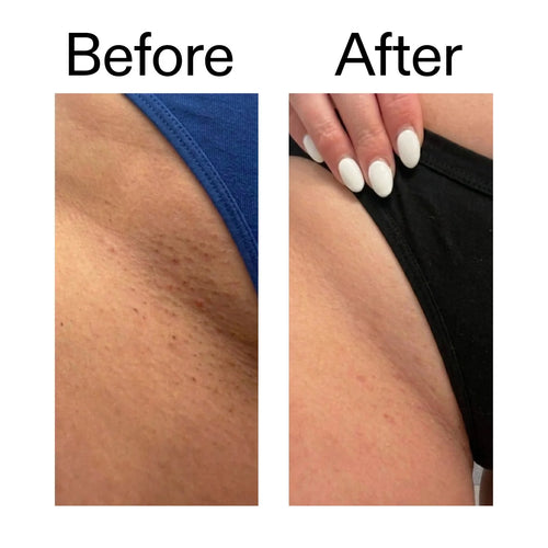 Smooth & Even Glycolic Body Stick